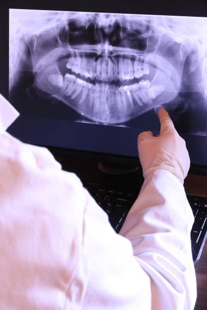 Best Emergency Dentist for Lost Fillings or Crowns in Gunter, TX